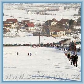 Ski centre Na Dlouh�ch Honech
